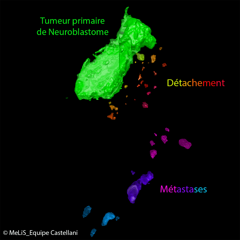 Modélisation du neuroblastome dans l’embryon aviaire. Sous l’action de signaux physiologiques émanant des tissus embryonnaires au sein desquels les tumeurs se développent, certaines cellules acquièrent des propriétés plus agressives, se détachent et disséminent pour établir des foyers métastatiques à distance. © MeLiS_Equipe Castellani