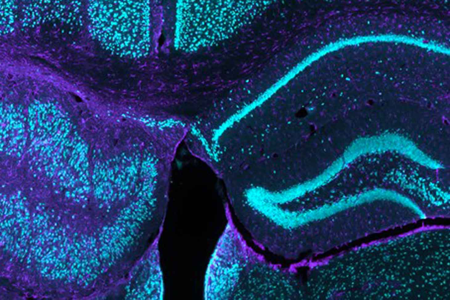 Marquages histologiques d’une souris épileptique irradiée avec la MRT ; les neurones sont représentés en bleu, et les astrocytes en violet. © Samalens et al., 2025, Epilepsia/Inserm