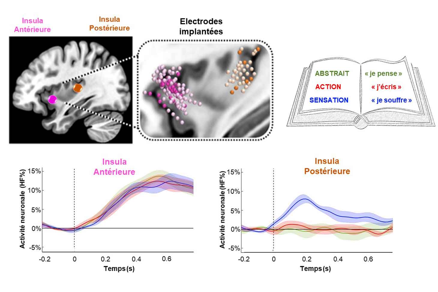 Contrairement à l’insula antérieure, qui ne présente pas de réponse sélective selon le type de mots, l’insula postérieure montre une réponse neuronale (en termes de pourcentage d’activité haute fréquence, HF%) spécifique aux phrases évoquant des sensations corporelles.