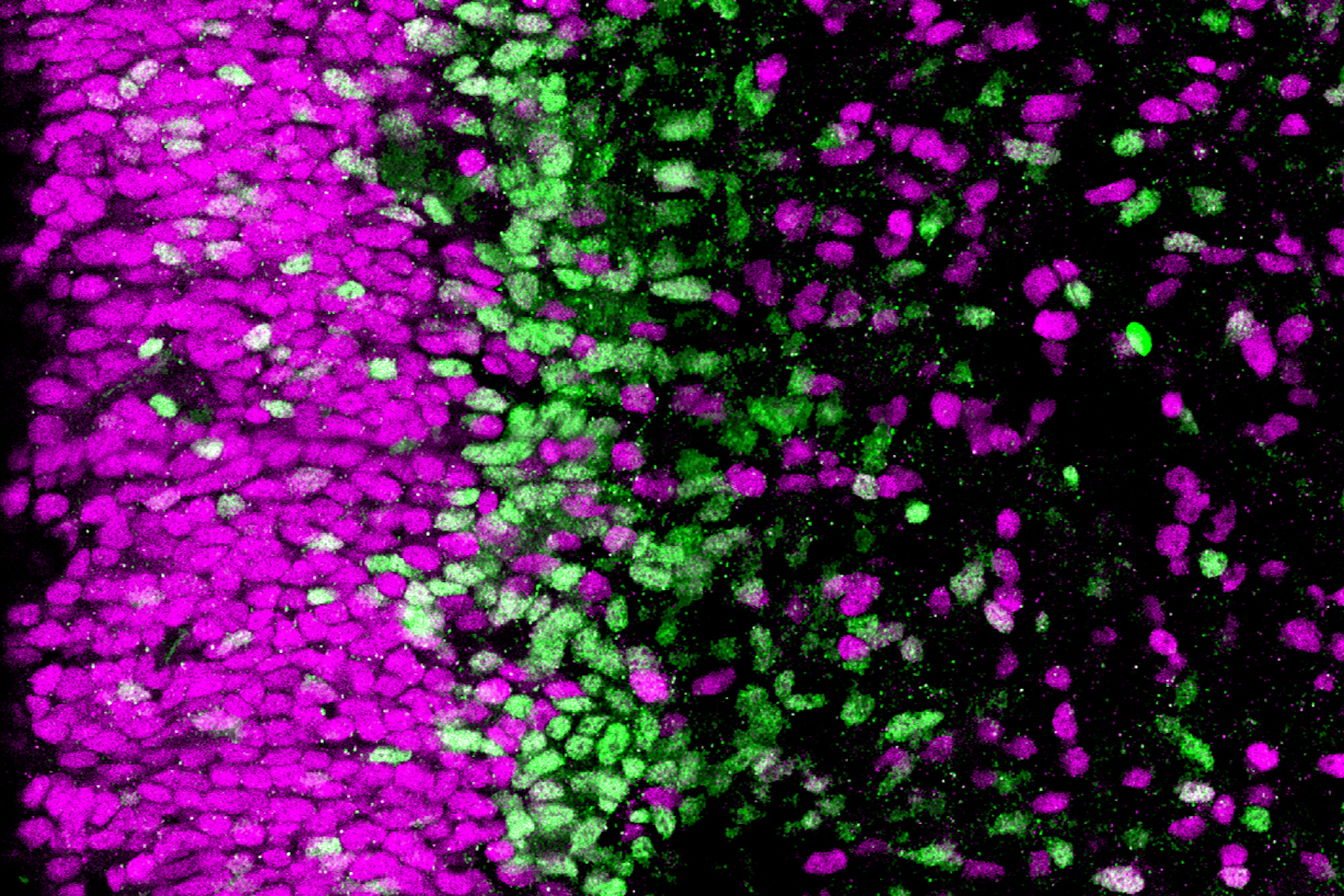 Coupe de cerveau humain (cortex). Les cellules progénitrices en magenta sont moins engagées dans la différenciation neuronale que celles en vert © Monia Barnat/Grenoble Institut des Neurosciences/Inserm, Université Grenoble Alpes
