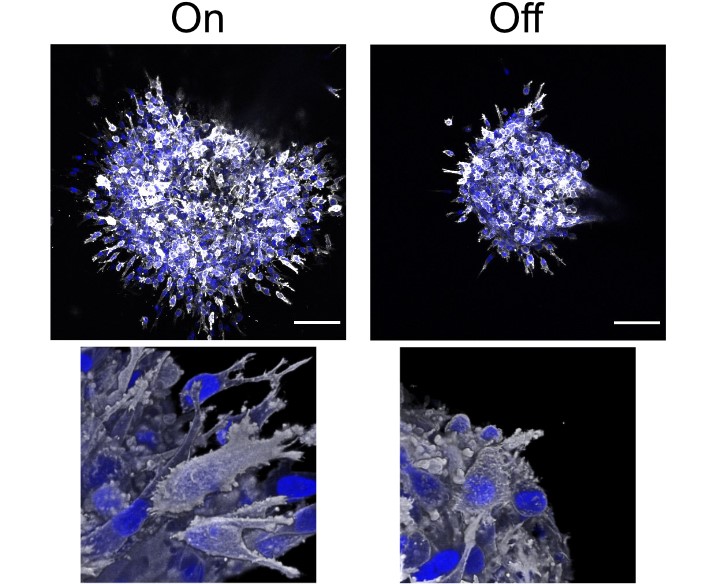 Illustration de la capacité d'invasion des cellules cancéreuses du sein avec (On) et sans (Off) stimulation par SMYD2 ; barre d‘échelle : 10µm. ©Casanova et al.