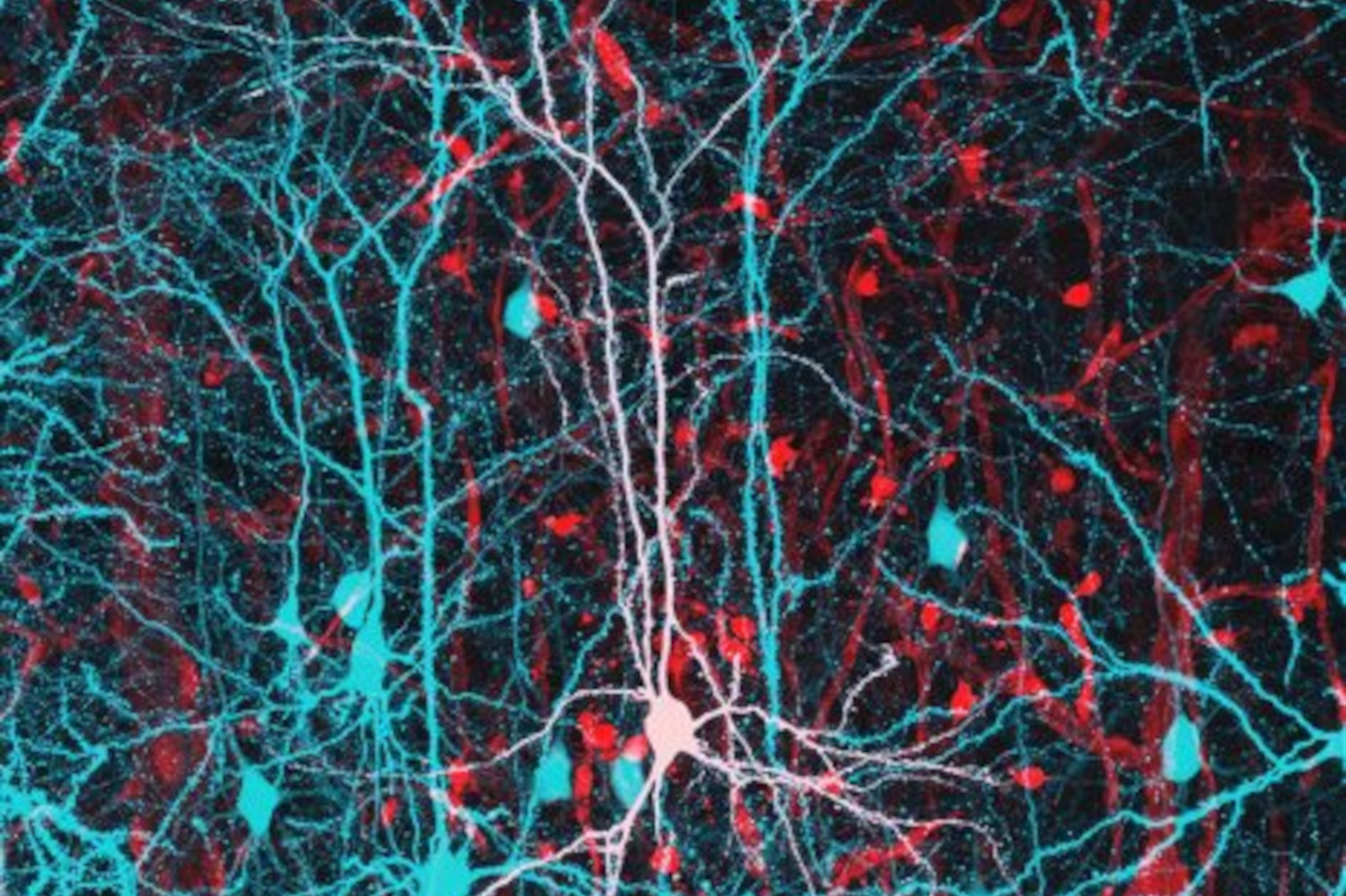 Neurones pyramidaux du cortex à 21 jours après la naissance dont l’activité et la morphologie sont similaires chez les souris contrôles et modèles de la maladie de Huntington alors qu’une semaine après la naissance des altérations sont observées. © Barbar