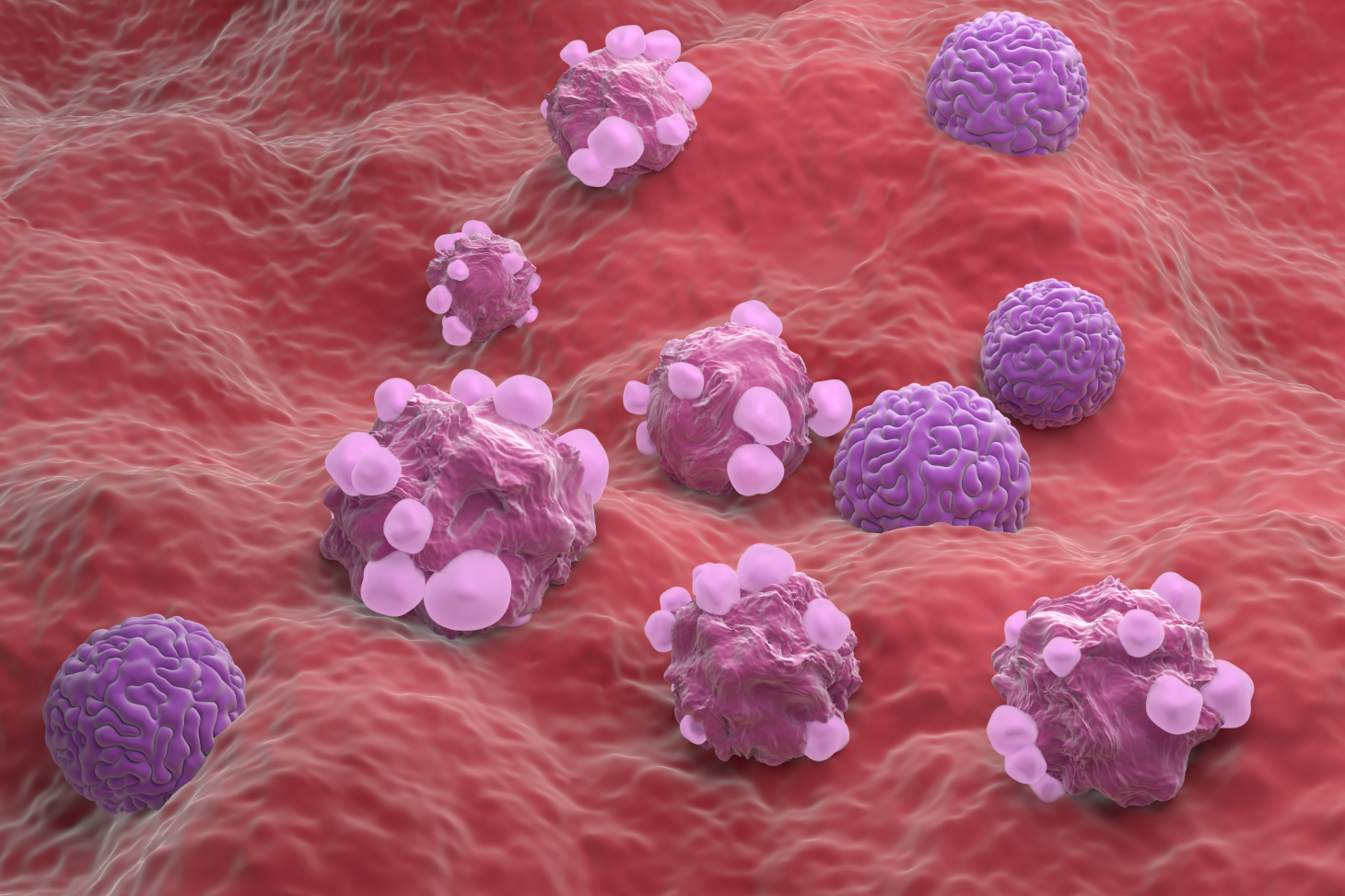 Cellules du cancer de l'ovaire - illustration 3d vue isomérique - Shutterstock