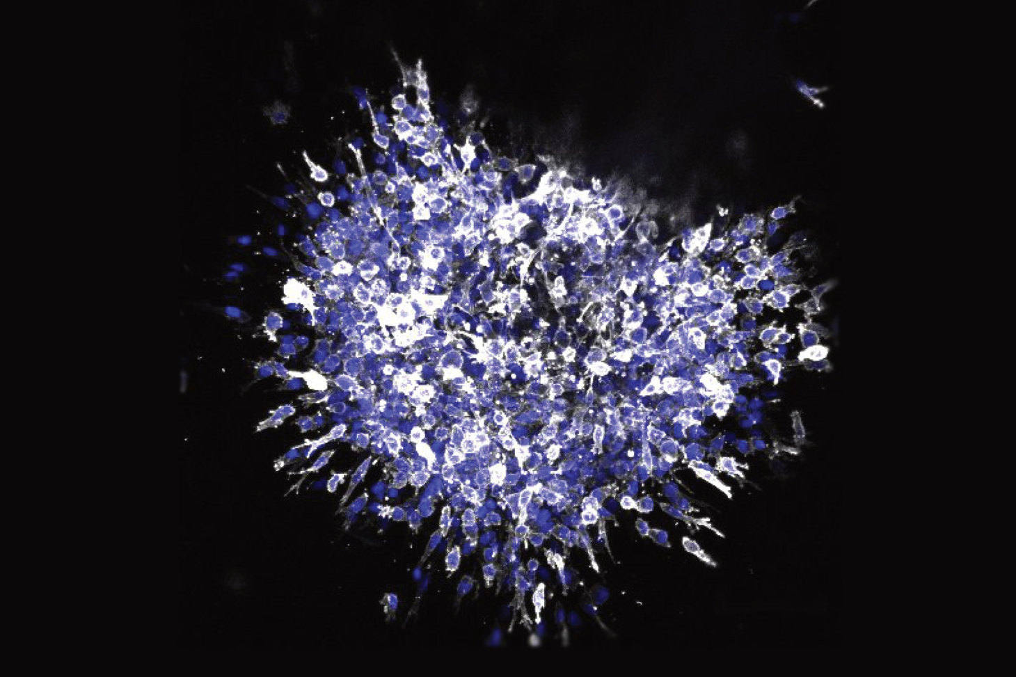 Illustration of the invasive capacity of breast cancer cells with SMYD2 expression ©Casanova & al.