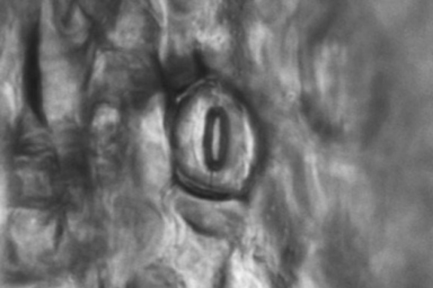 Nucléation d'une bulle de cavitation laser dans dans un stomate sur surface d'une feuille de plante, ici la Sélaginelle (Selaginella Kraussiana) © Craig Brodersen